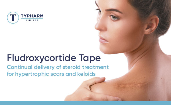 Fludroxycortide Tape: Continual delivery of steroid treatment for hypertrophic scars and keloids